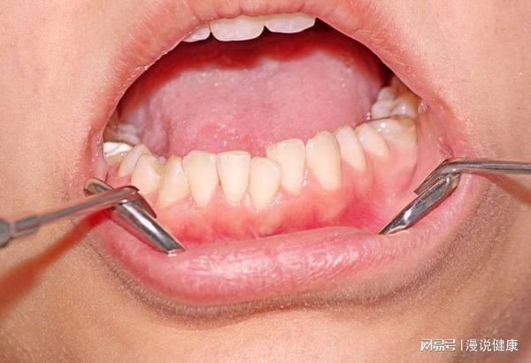 口腔問題頻頻出現(xiàn)？別不當(dāng)回事，它的健康與全身健康息息相關(guān)！